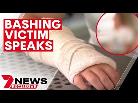 kirra getting bashed|Family’s horror as teen girl bashed, tortured